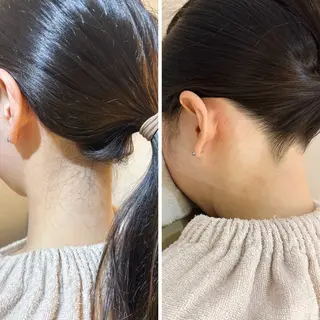 うなじ脱毛/美肌脱毛 LABELのエステ・リラクイメージ