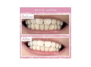 セルフホワイトニング エクシア大阪梅田店のその他イメージ