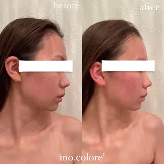 エステサロンino.colore'所属・小顔サロン ino.coloreのエステ・リラクイメージ