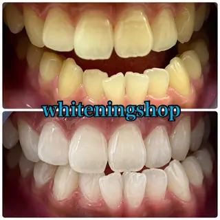 ホワイトニング ショップ吉祥寺店のエステ・リラクイメージ