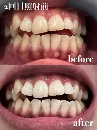 𝐑𝐞𝐯𝐢𝐨 ___堺市西区のマツエク・マツパデザイン