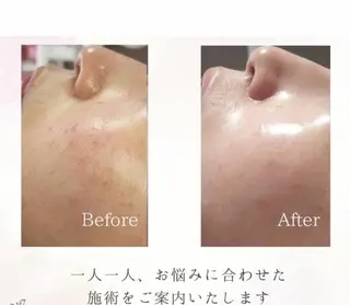 痩身専門サロン マハロミのエステ・リラクイメージ