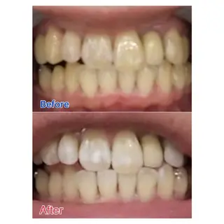 MBEAUTYSALON 千葉店・京成大久保所属・Melty 輝のその他イメージ