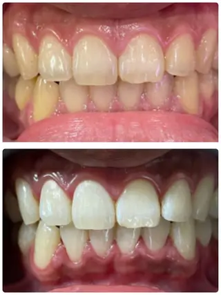 nail salon Na.(エヌエー)所属・nailsalon Na.のネイルデザイン