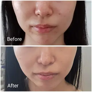 Salon de  HiAのエステ・リラクイメージ