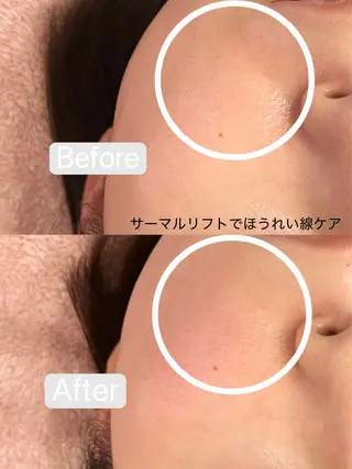 アイラッシュ&エステサロンLinda西宮所属・小顔&毛穴・肌質改善 LINDA西宮 AIのエステ・リラクイメージ