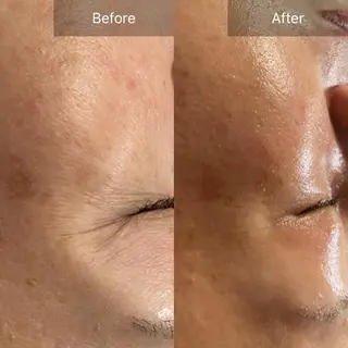 Mandarin Orange所属・毛穴から始める肌メン テマンダリンオレンジのエステ・リラクイメージ