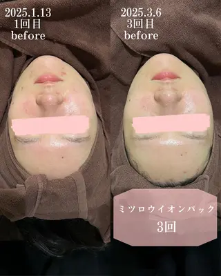 merveilles所属・まつげ/整体/にきび ・アトピー専門サロンのマツエク・マツパデザイン