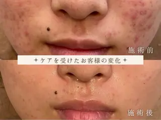 Anpawman所属・Anpawman アンパウマンのエステ・リラクイメージ