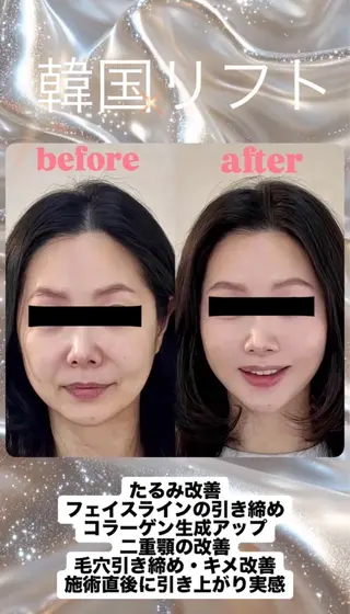 ネイル aliaハイフ&水光ジェットサロン所属・aliaハーブ水光店 エステティシャン募集のエステ・リラクイメージ