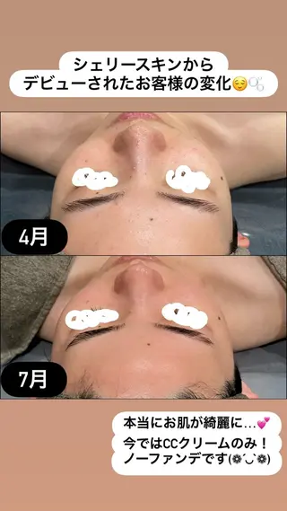 LiZA エステティックサロンのエステ・リラクイメージ