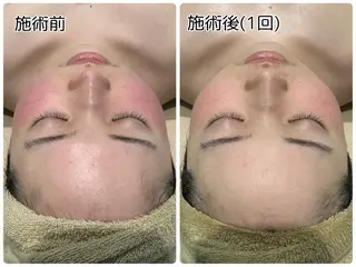 小顔FaceLabo.那覇店所属・小顔フェイスラボ 那覇店のエステ・リラクイメージ