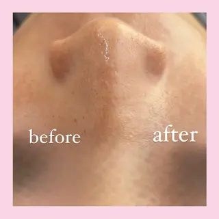 韓国肌管理専門店　White labo 宝塚店所属・有川 凜のエステ・リラクイメージ