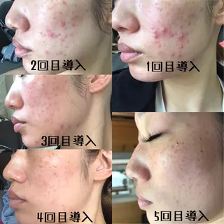 マツエク・マツパ withサロン所属・withサロン/パリ 2600円サロンのマツエク・マツパデザイン