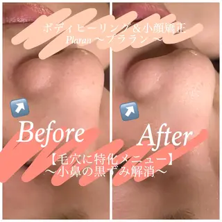 Plaran 〜プララン 〜のその他イメージ