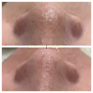 ビューティー ミロワールのエステ・リラクイメージ