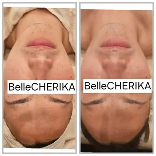 ベル チェリカ 三城のエステ・リラクイメージ