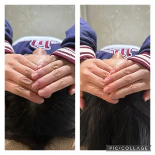 小顔矯正 MEGUMIのエステ・リラクイメージ