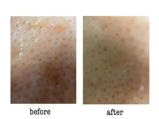 デアイム高島平所属・兼松 美香のエステ・リラクイメージ