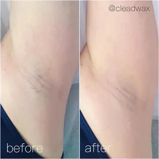 CLEAD 赤坂見附店のエステ・リラクイメージ