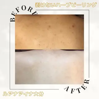 ルアナアイナ 大分のエステ・リラクイメージ