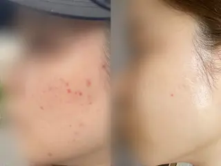 CPサロン川口駅前店所属・honda mikiのエステ・リラクイメージ