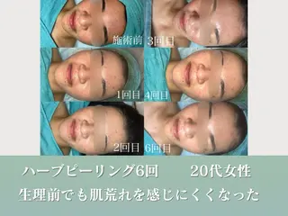 潤い艶肌/肌質改善 YUKAのエステ・リラクイメージ