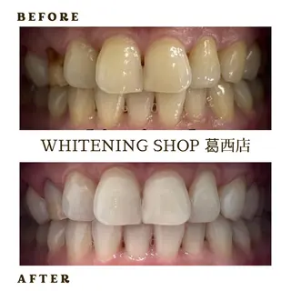 メンズ ホワイトニング ショップ葛西店のその他イメージ