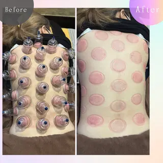 鍼灸院楽々館所属・宇田 碧のエステ・リラクイメージ