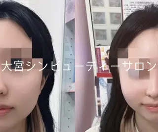 シン ビューティー ひなのエステ・リラクイメージ