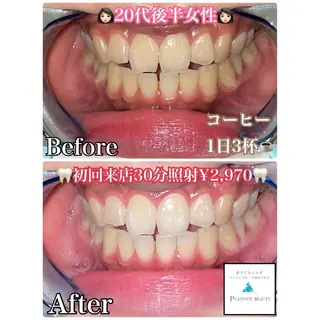 セルフホワイトニングビューティー三川店所属・中村 江梨香のその他イメージ