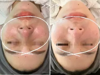 肌質改善 KALANCHOEのエステ・リラクイメージ