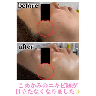 Beauty salonBellのエステ・リラクイメージ