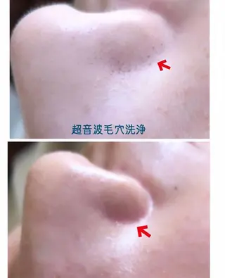 DISINI  SPA所属・DISINISPA 脱毛/フェイシャルのエステ・リラクイメージ