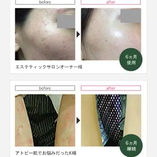 LEA MUSASHIKOSUGI所属・美肌育成サロン LEA武蔵小杉のエステ・リラクイメージ