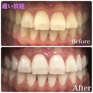 LOVE ホワイトニング渋谷のその他イメージ