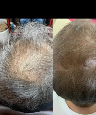 Espoir /エスポワール所属・三澤 秀基のエステ・リラクイメージ