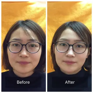 美容鍼・整体 根本改善/小林幸司のエステ・リラクイメージ