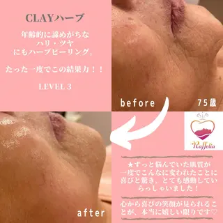 🌈Raffelia ラフェリア✨のエステ・リラクイメージ