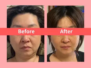 痩身&小顔矯正専門店 Re:Livesのエステ・リラクイメージ