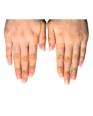 ネイル 深爪矯正専門店ネイルサロンKUU所属・ネイルサロン KUUのネイルデザイン