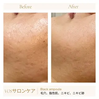 1ヶ月後も半分残る 高持続LEDエクステのマツエク・マツパデザイン