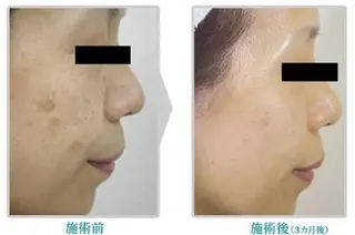 Diasalon関内 ディアサロンカンナイのエステ・リラクイメージ