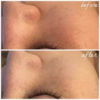 メンズ メナード岐阜市茜部 杉浦のエステ・リラクイメージ