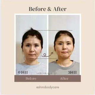 小顔美容矯正勝山式 shiroしろのエステ・リラクイメージ