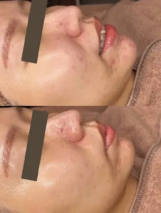 安川 陽向のエステ・リラクイメージ