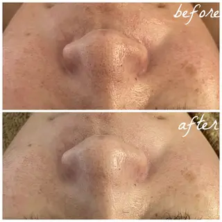 メンズ メナード岐阜市茜部 杉浦のエステ・リラクイメージ