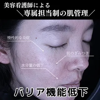 美容看護師専属担当制 医学に基づく肌管理のエステ・リラクイメージ