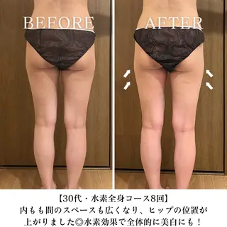 【目黒】本格痩身✴︎ 最新型よもぎ蒸しのエステ・リラクイメージ