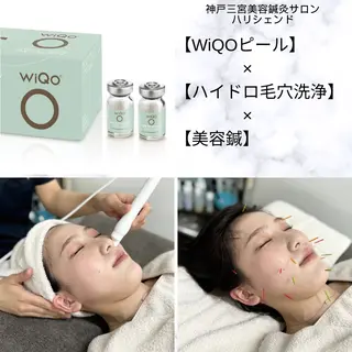 美容鍼・小顔矯正 ハリシェンドのエステ・リラクイメージ